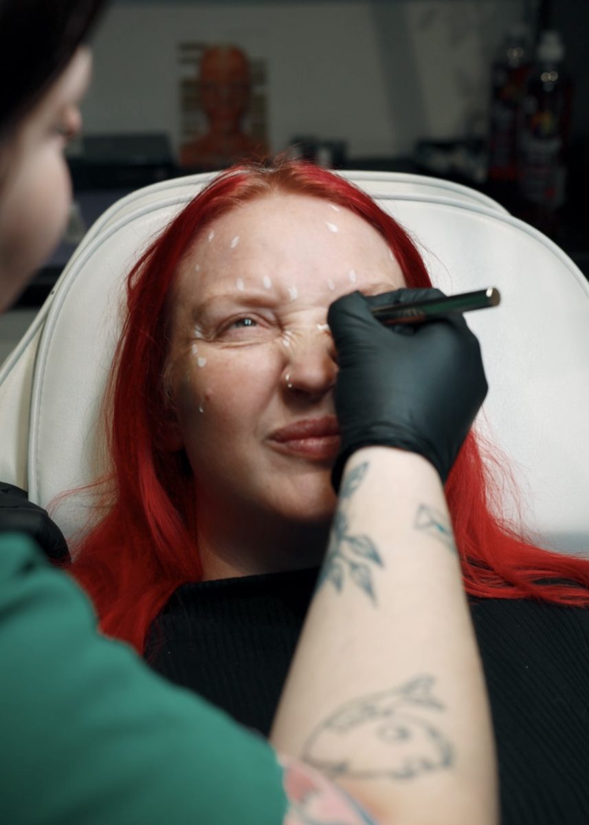 Facial mapping during a treatment consultation